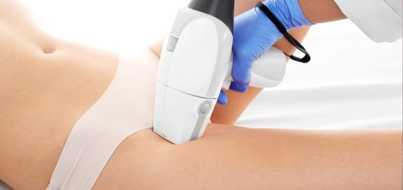 FOTODEPILACION-LASER-MOURE-MUJER-IPL-LIGHT-4