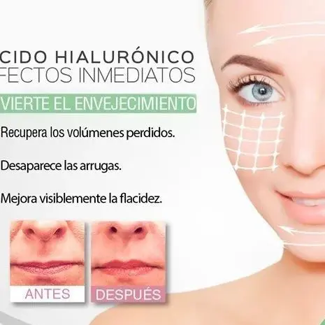 HACIDO-HIALURONICO-BENEFICIOS-.-CENTRO-DE-ESTE-TICA-MOURE-MALLORCA-6