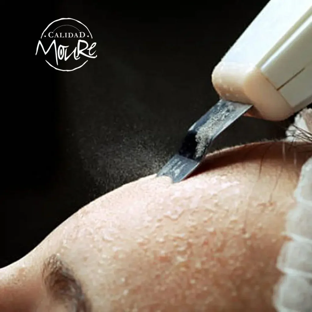 LIMPIEZA-DE-CUTIS-APARATOLIGIA-MASCARILLA-ULTRASONIDOS-ALTA-FRECUENCIA-4