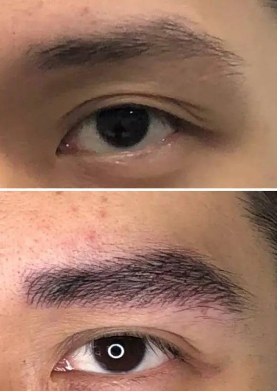MICROPIGMENTACION-DE-CEJAS-HOMBRE-MOURE-5-1-scaled