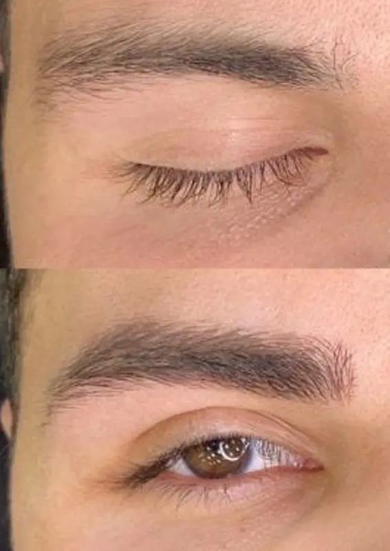 MICROPIGMENTACION-DE-CEJAS-HOMBRE-MOURE-8-2-scaled