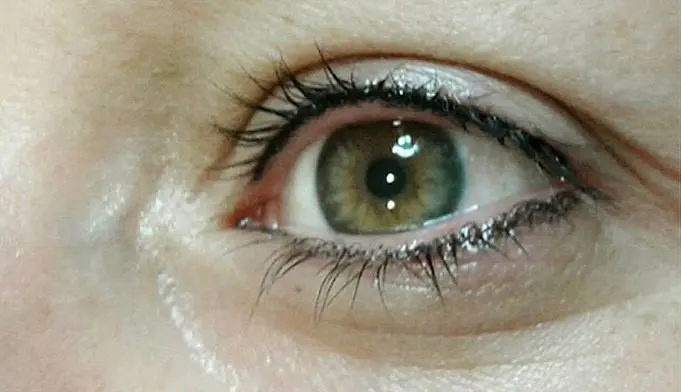 MICROPIGMENTACION-DE-OJOS-Y-PESTANAS-MOURE-ANTES-Y-DESPUES-3