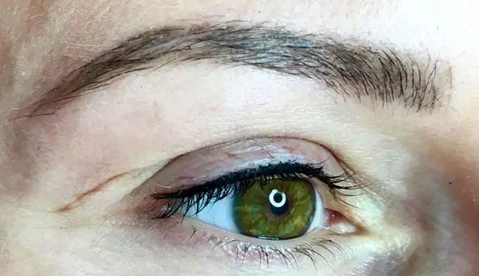 MICROPIGMENTACION-DE-OJOS-Y-PESTANAS-MOURE-ANTES-Y-DESPUES-6