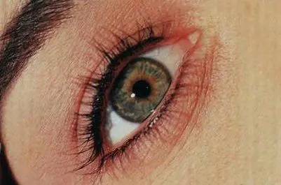MICROPIGMENTACION-DE-OJOS-Y-PESTANAS-MOURE-ANTES-Y-DESPUES-7