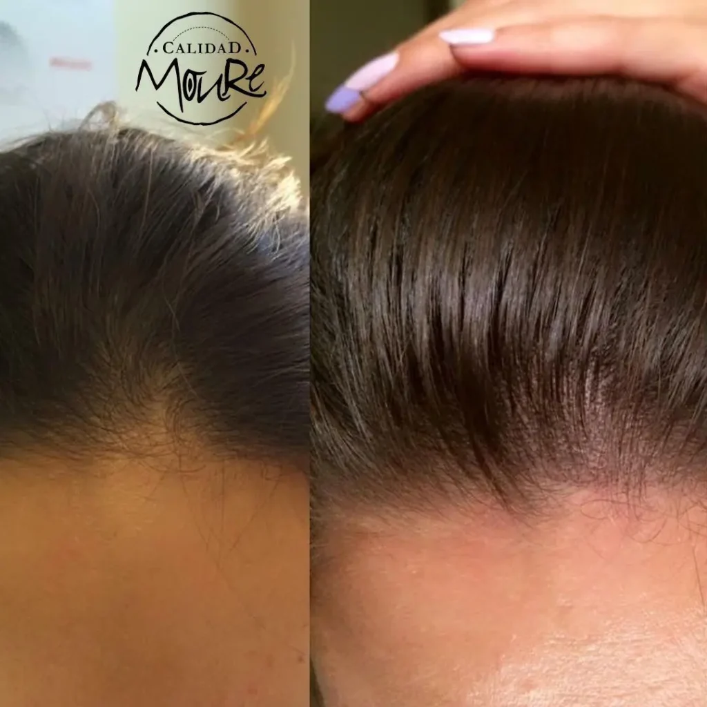 MICROPIGMENTACION-MUJER-MOURE-MAS-DENSIDAD-PELO-LARGO-13