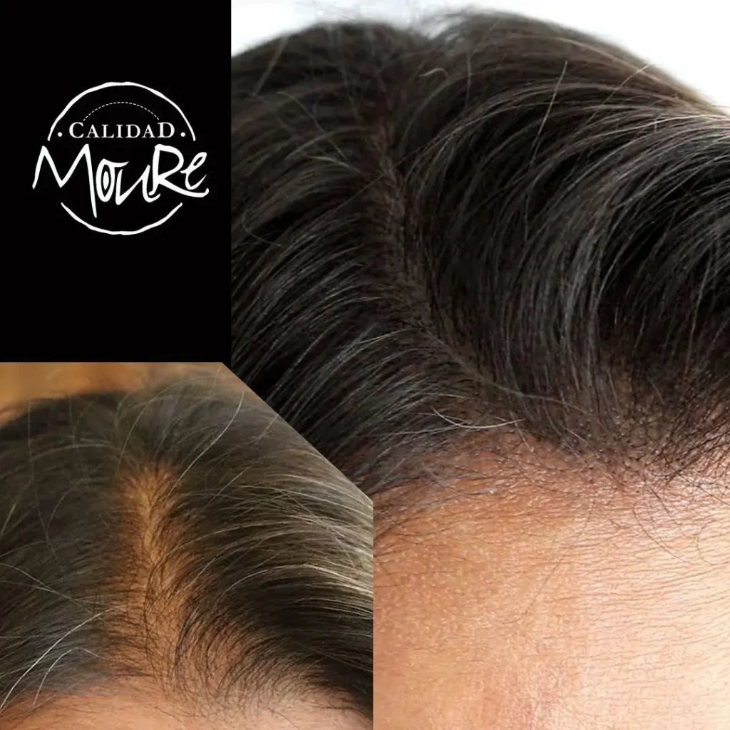MICROPIGMENTACION-MUJER-MOURE-MAS-DENSIDAD-PELO-LARGO-14