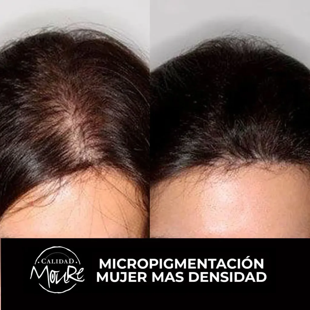 MICROPIGMENTACION-MUJER-MOURE-MAS-DENSIDAD-PELO-LARGO-18