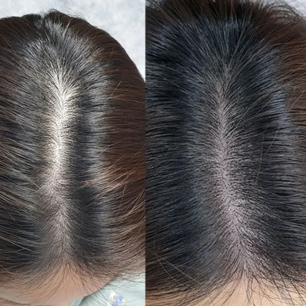 MICROPIGMENTACION-MUJER-MOURE-MAS-DENSIDAD-PELO-LARGO-2