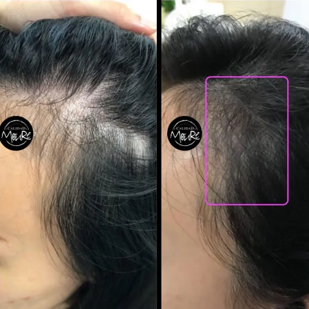 MICROPIGMENTACION-MUJER-MOURE-MAS-DENSIDAD-PELO-LARGO-5