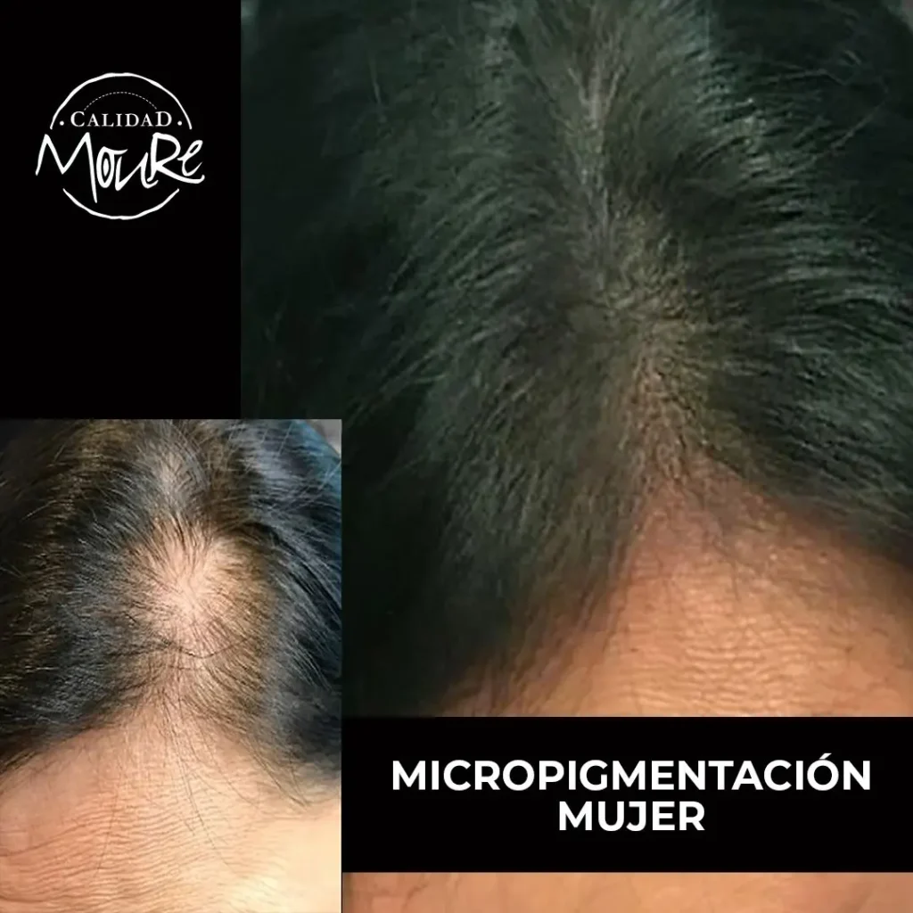 MICROPIGMENTACION-MUJER-MOURE-MAS-DENSIDAD-PELO-LARGO-6