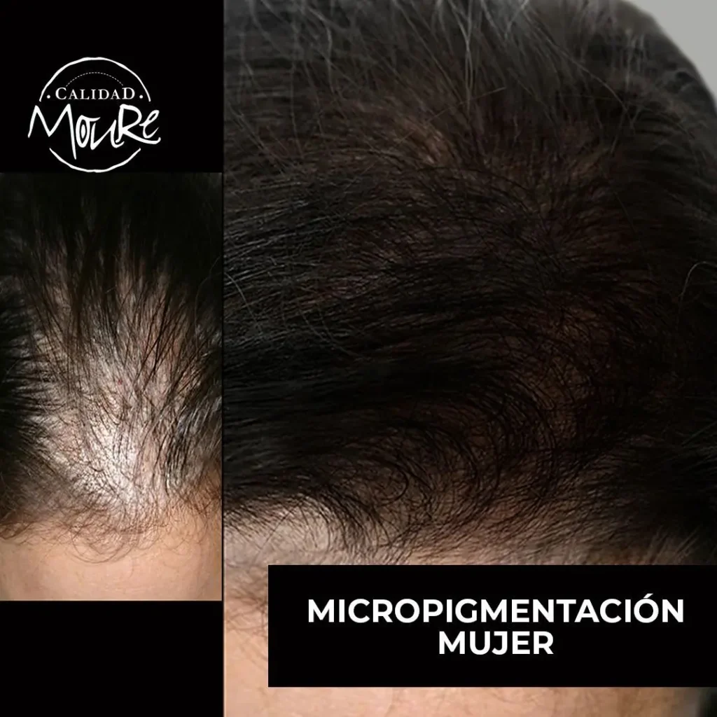 MICROPIGMENTACION-MUJER-MOURE-MAS-DENSIDAD-PELO-LARGO-8