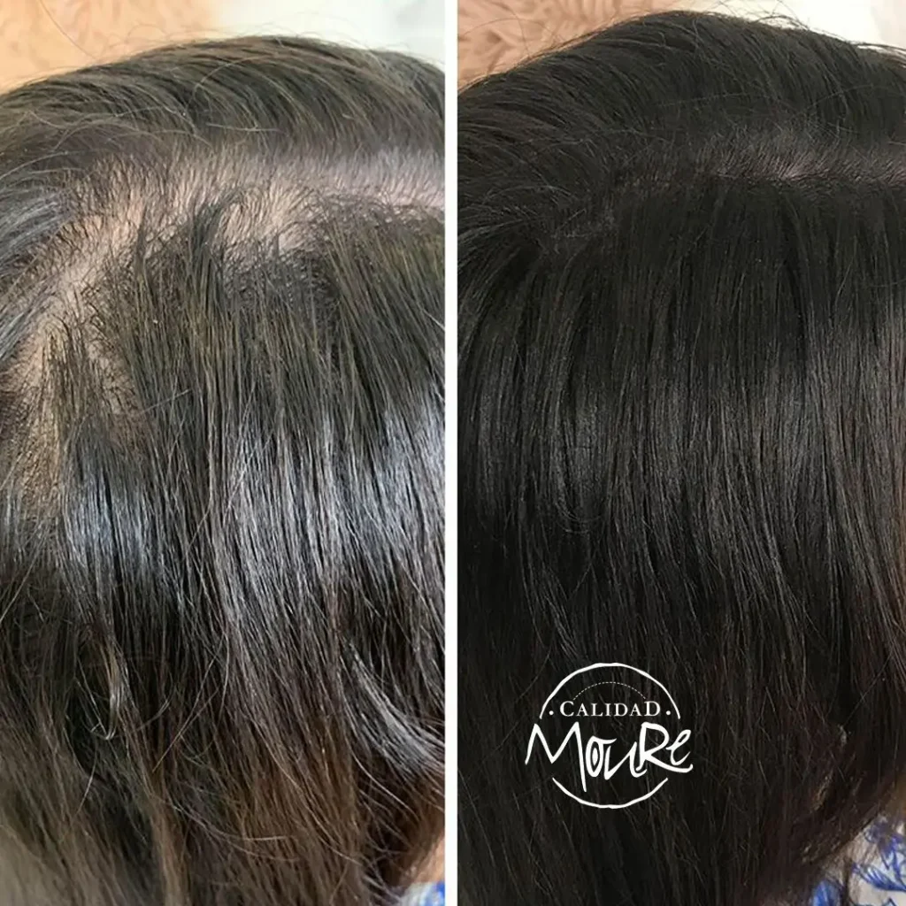 MICROPIGMENTACION-MUJER-MOURE-MAS-DENSIDAD-PELO-LARGO-9