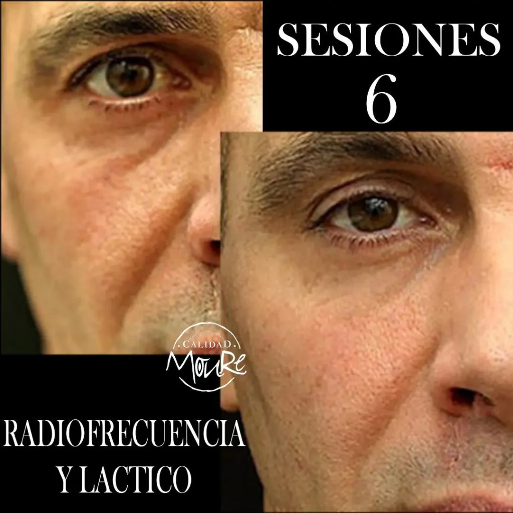 RADIOFRECUENCIA-LASER-GALVANICA-Y-ACIDO-HIALURONICO-CENTRO-DE-ESTETICA-MOURE-MALLORCA-13