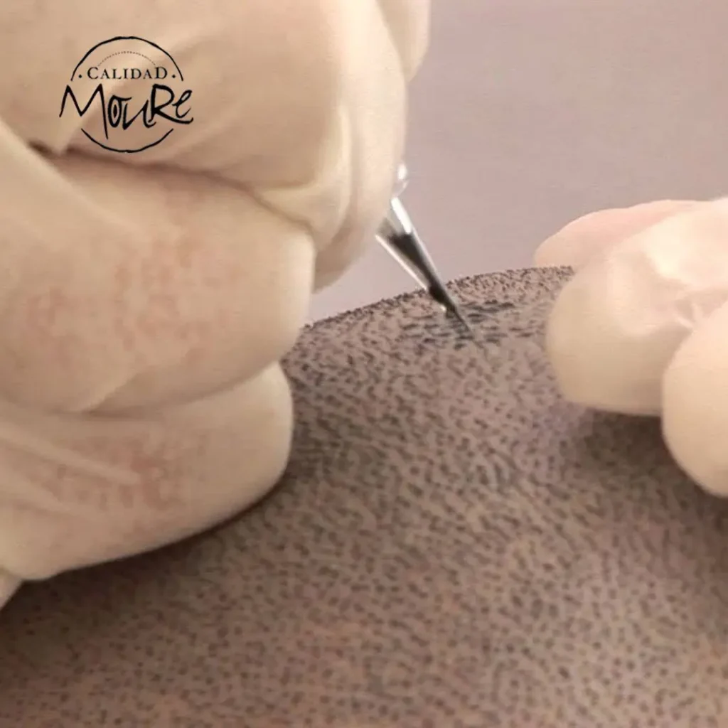 TECNICA-DE-REALIZACION-DE-MICROPIGMENTACION-CAPILAR-5