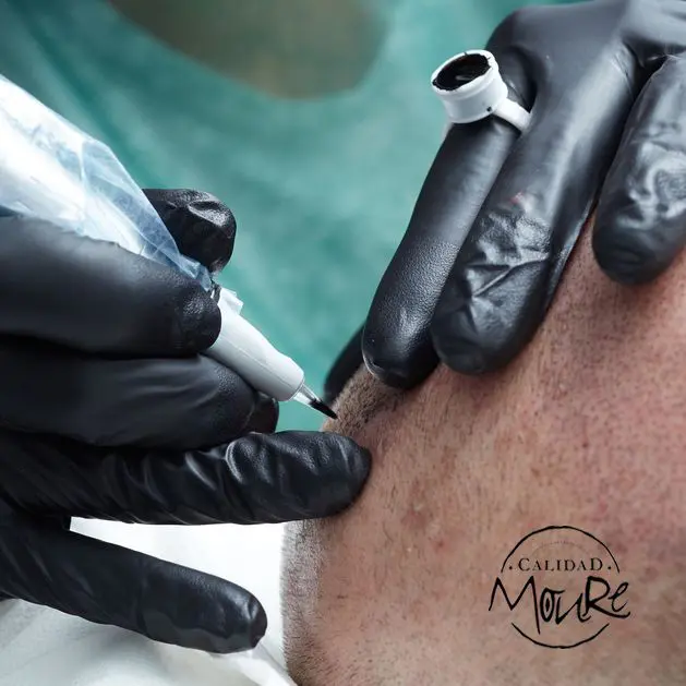 TECNICA-DE-REALIZACION-DE-MICROPIGMENTACION-CAPILAR-6