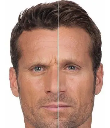 TRATAMIENTO-FACIAL-HOMBRE-ANTES-Y-DESPUES-BARBERIA-PELUQUERIA-MALLORCA-MOURE-1