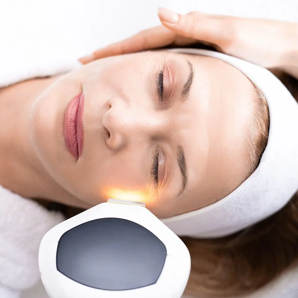 TRATAMIENTO-FOTOREJUVENECIMIENTO-FACIAL-CENTROS-MOURE-MALLORCA-4