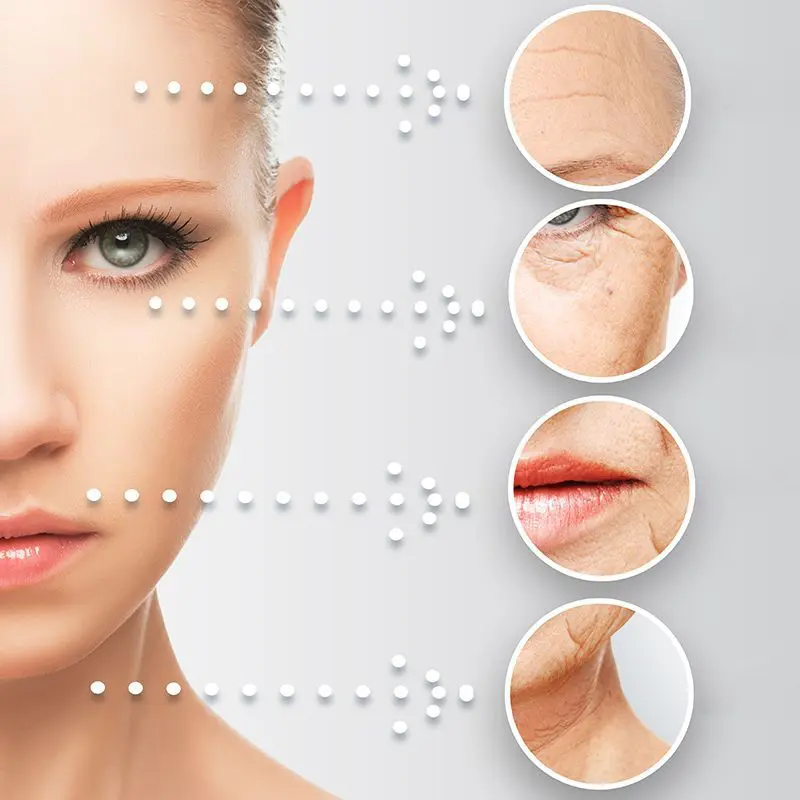 TRATAMIENTO-FOTOREJUVENECIMIENTO-FACIAL-CENTROS-MOURE-MALLORCA-5