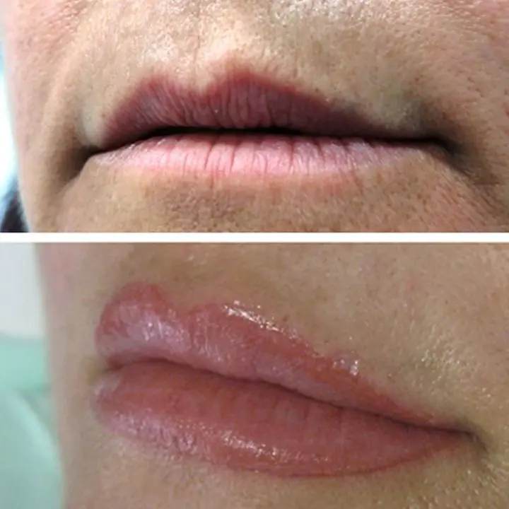antes-y-despues-micropigmentacion-de-labios-3