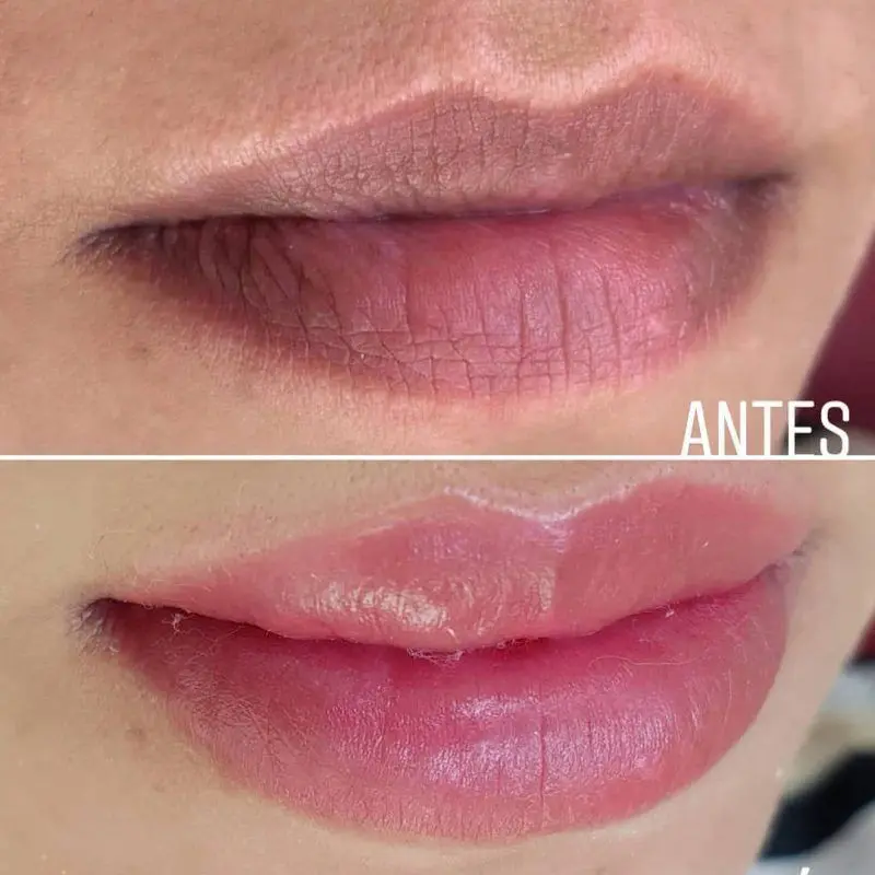 antes-y-despues-micropigmentacion-de-labios-6