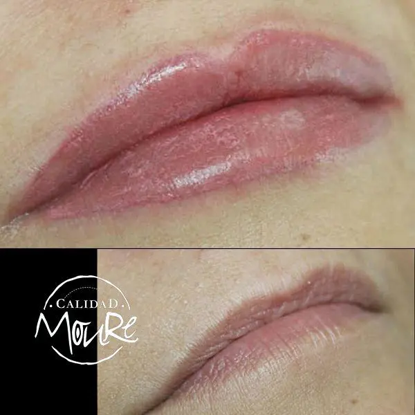 antes-y-despues-micropigmentacion-de-labios-9