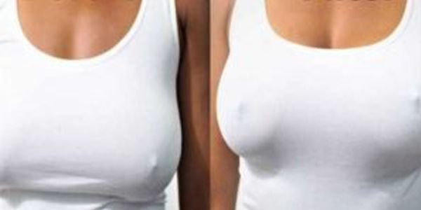 antes-y-despues-tratamiento-de-pecho-4