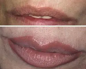 dermopigmentacion-cejas-labios-tatoo-maquillaje-permanente-428405-MLA25010906338_082016-O-300x241-1