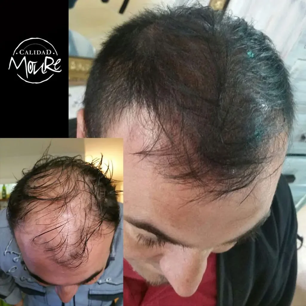 nuevos-23-a